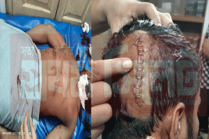 শ্রীমঙ্গলে ছিনতাইকারীদের হাতে সহোদর ব্যবসায়ী আহত
