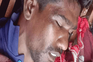 দিরাইয়ে বিদ্যুতায়িত হয়ে স্বামীর মৃত্যু,গুরুতর আহত স্ত্রী